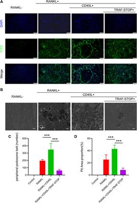 TRAF-STOP alleviates osteoclastogenesis in periodontitis